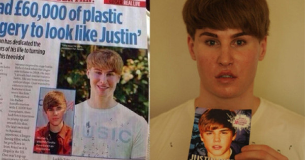Justin Plastic Surgery